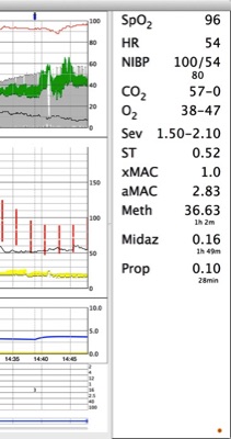 Screen Shot 2013 10 14 at 14.47.54